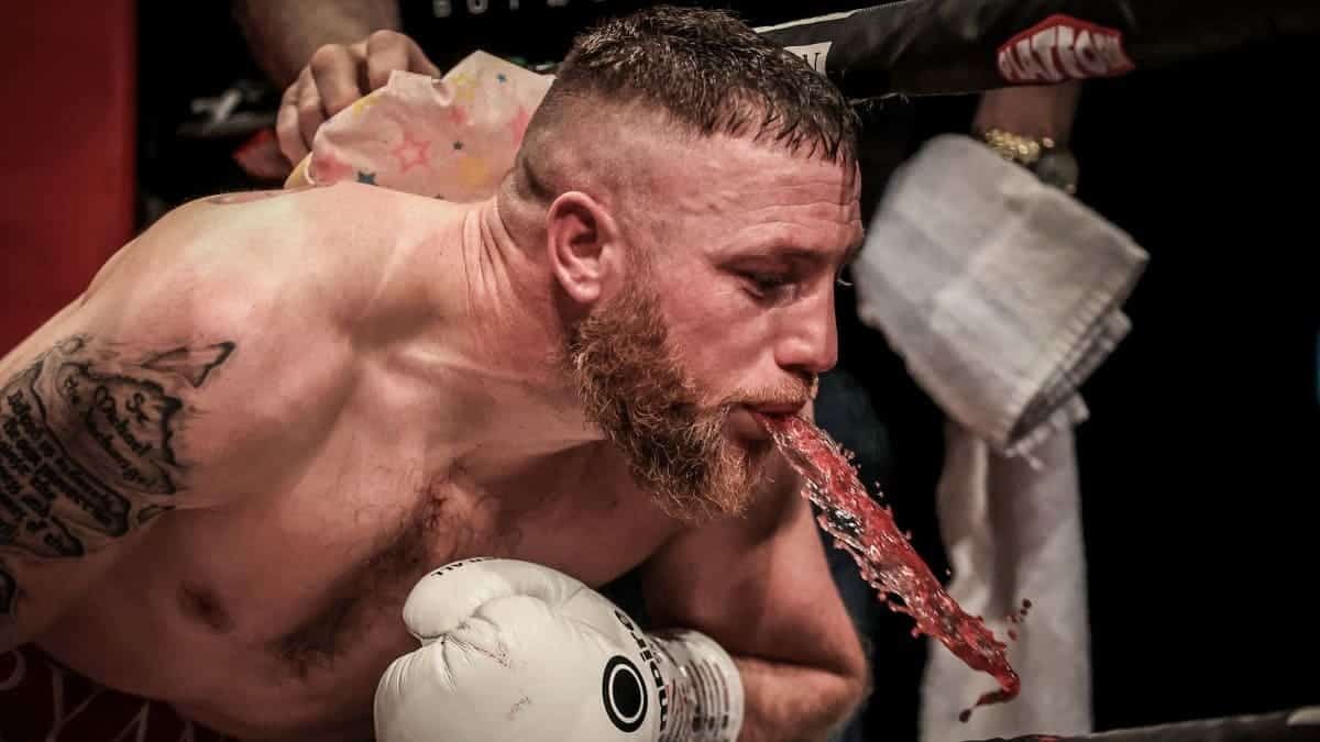 Ray Moylette spit bucket
