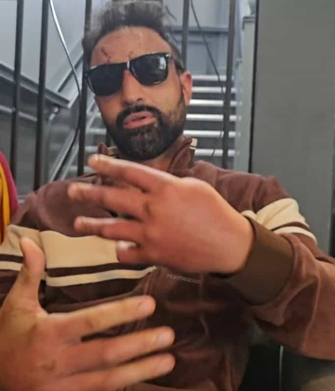 Paulie Malignaggi montre ses mains endommagées suite au retour des articulations nues