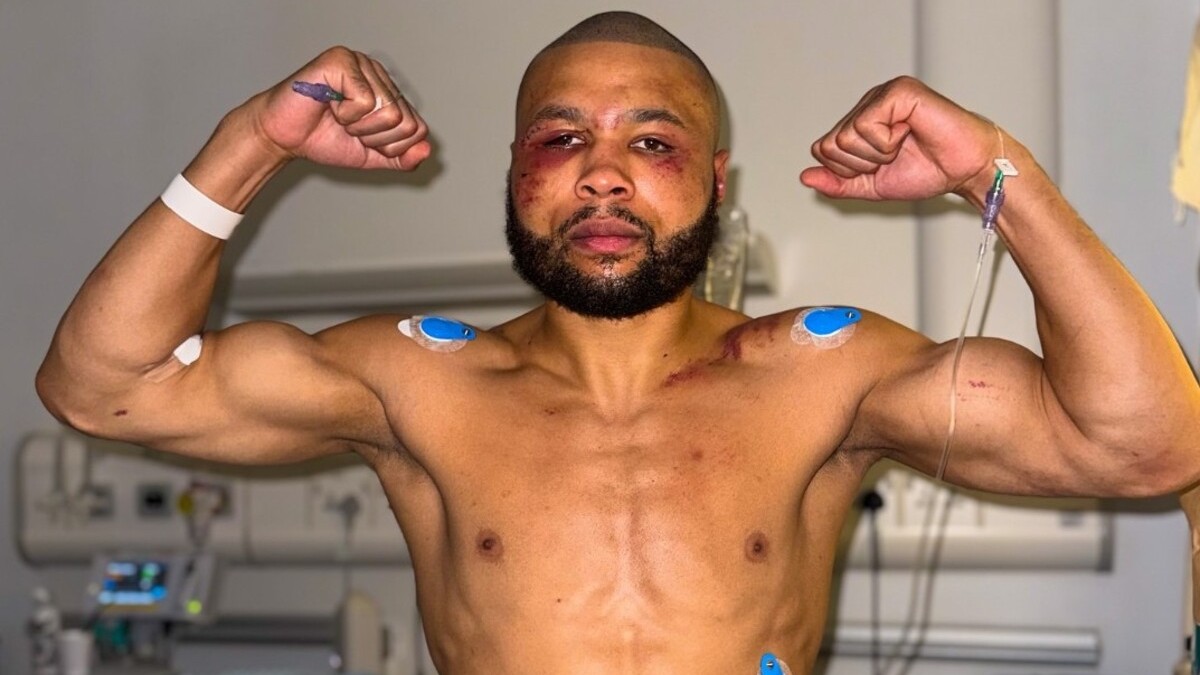 Le visage mutilé d'Eubank Jr. enflamme la fureur suite au retard de l'ambulance