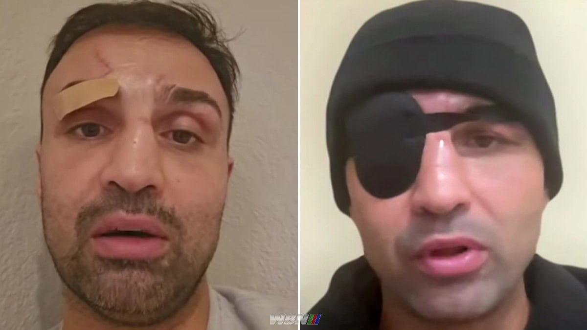 Toujours brumeux : Malignaggi porte un cache-œil des semaines après la victoire brutale du BKB