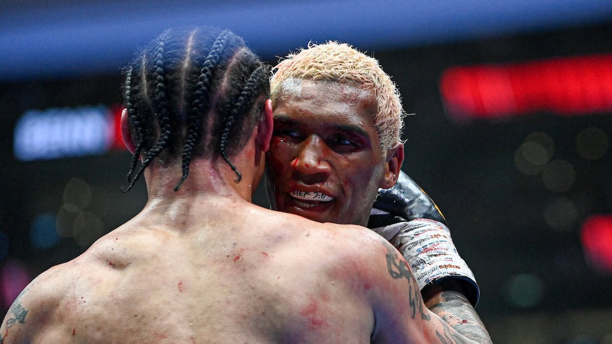 Conor Benn bleeds heavily during his unanimous decision win over injured Regis Prograis at Tottenham Hotspur Stadium in London
