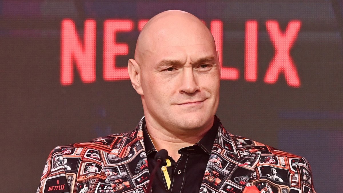 Tyson Fury 2026 face