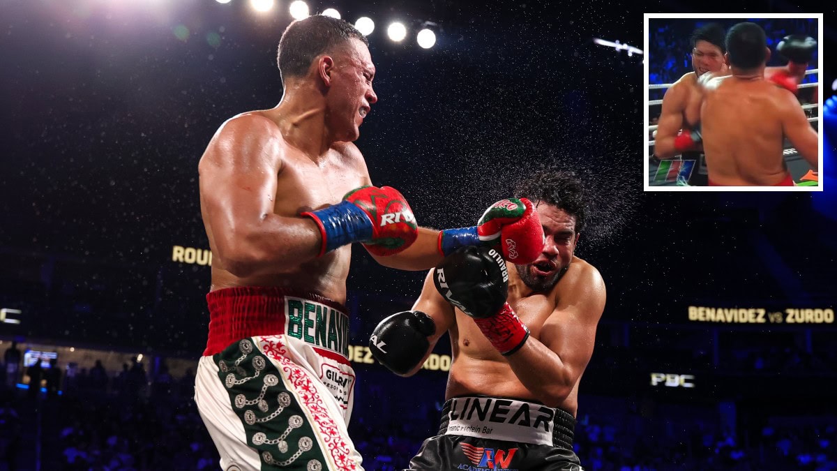 David Benavidez elbow