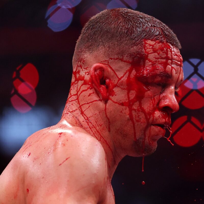 Nate Diaz couvert de sang lors de son brutal combat de MMA avec Mike Perry lors du premier événement Netflix de MVP.