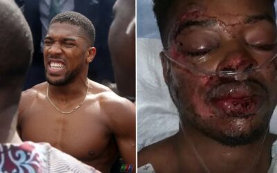 Anthony Joshua et Errol Spence Jr. chanceux d'être en vie après des accidents de voiture d'horreur
