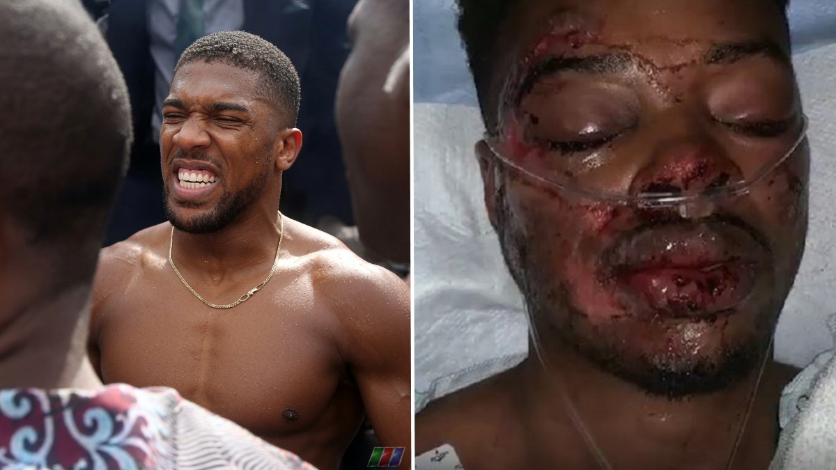 Anthony Joshua et Errol Spence Jr. chanceux d'être en vie après des accidents de voiture d'horreur